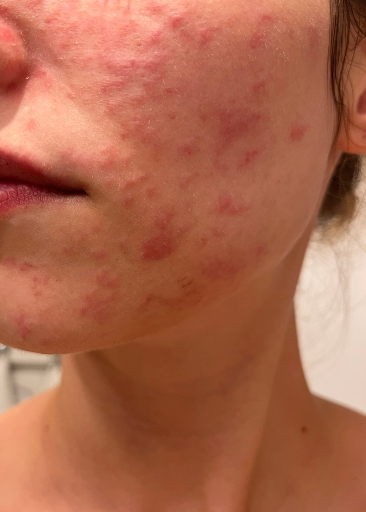 CICACARE — zdjęcie przed pielęgnacją