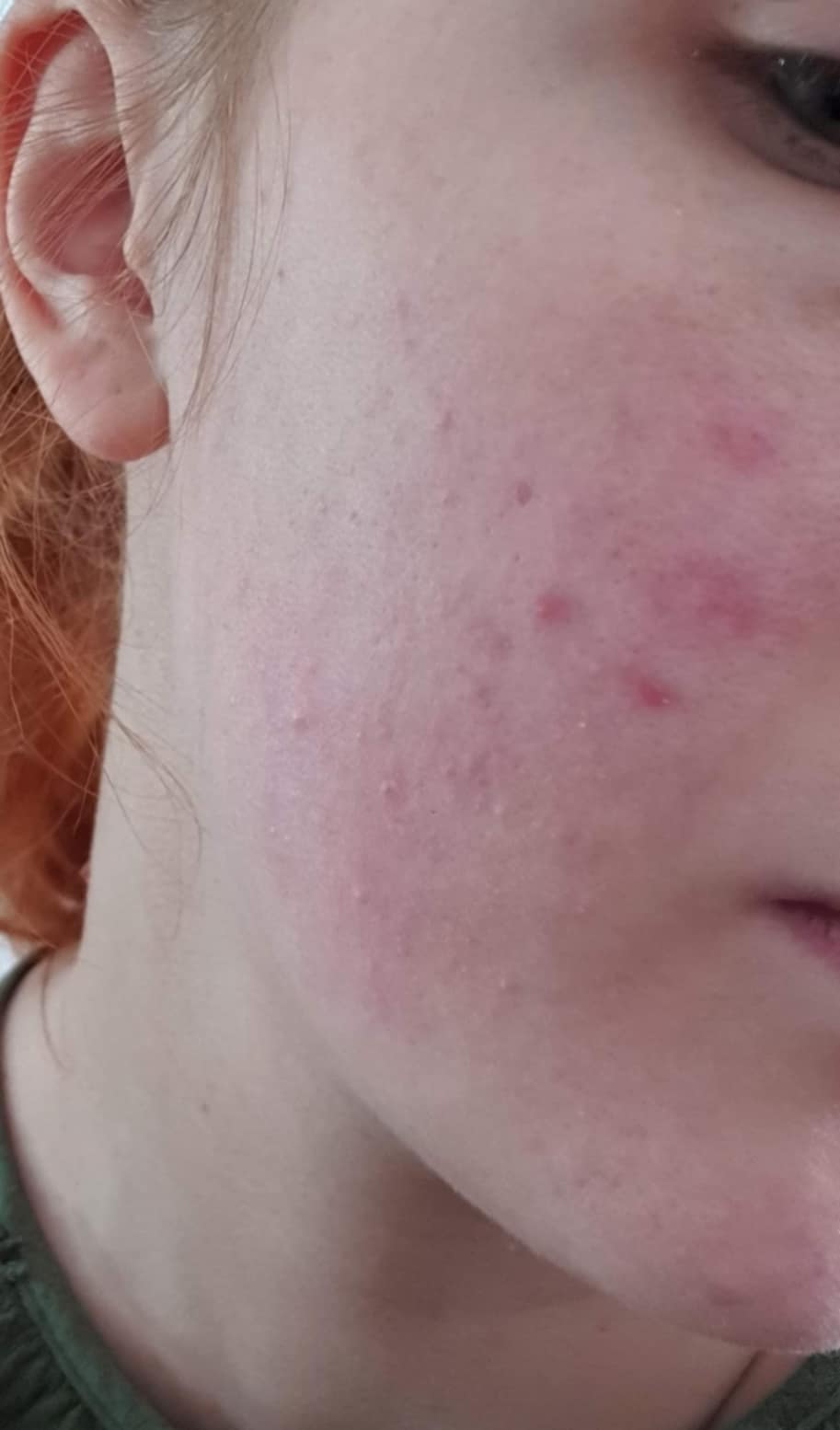 CICACARE — zdjęcie przed pielęgnacją